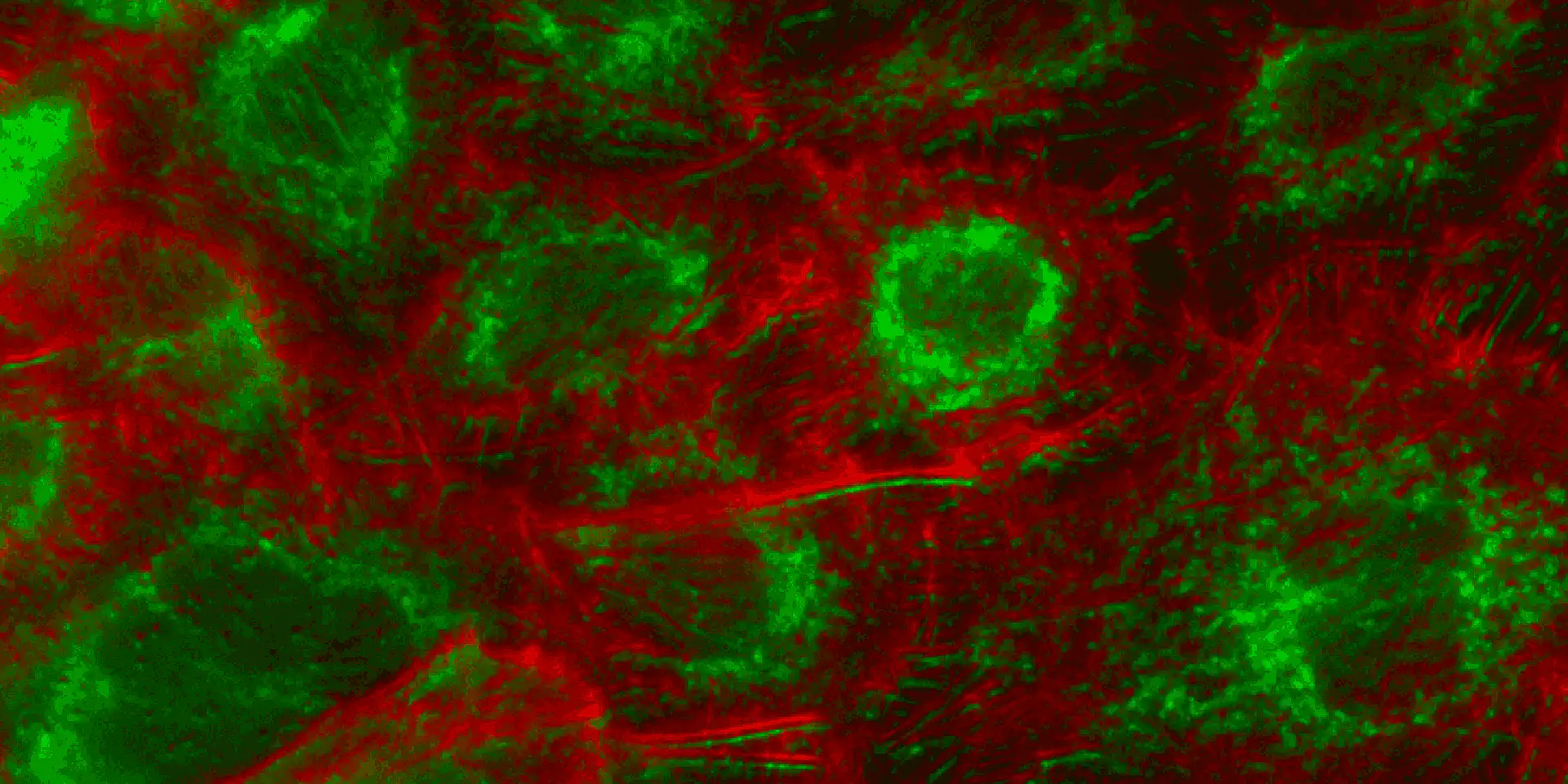 Modulátor svazku pro fluorescenční mikroskopii