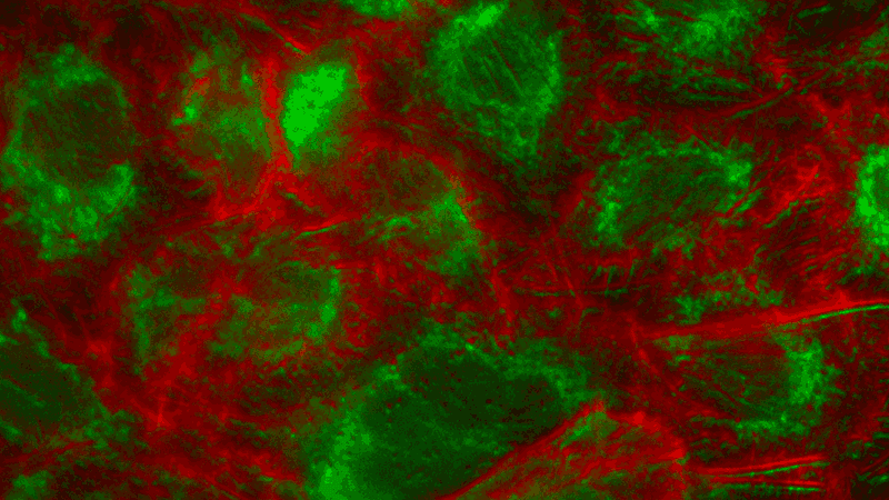Strahlformer für Fluoreszenzmikroskopie