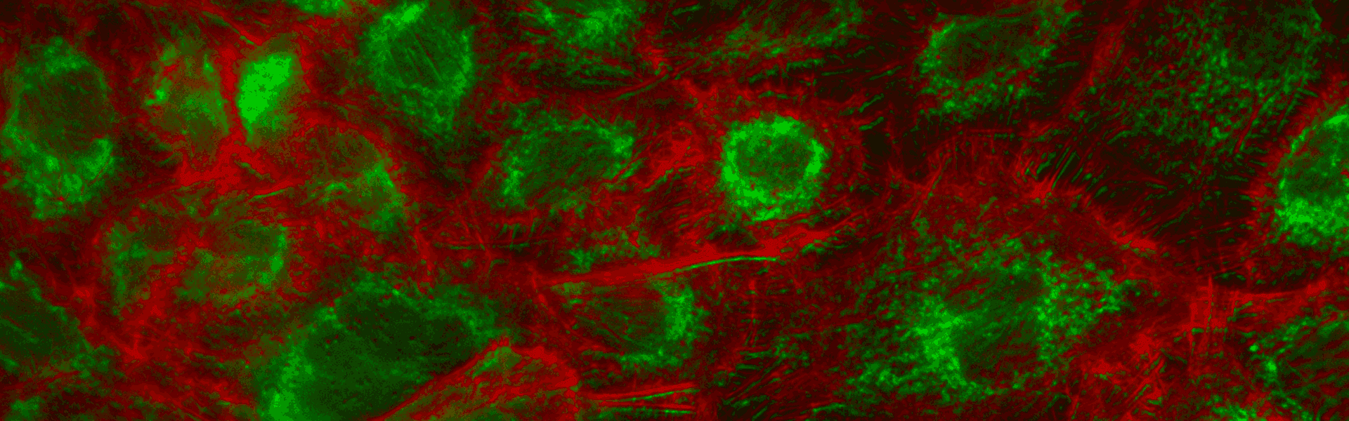 Modulátor svazku pro fluorescenční mikroskopii