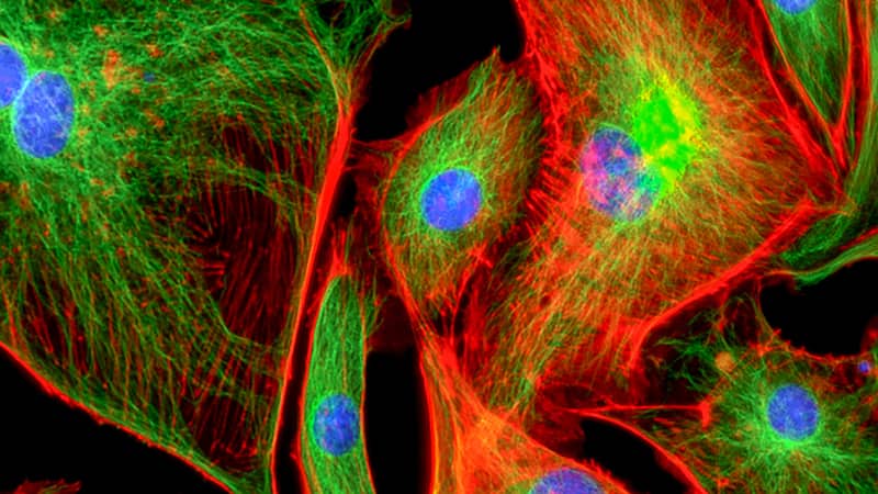 Fluoreszenzmikroskopie