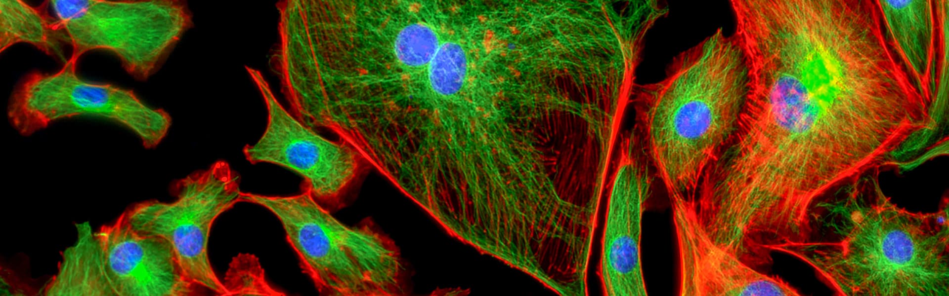 Fluoreszenzmikroskopie