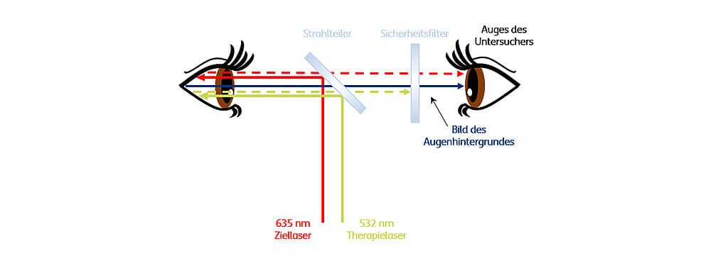 Abbildung: Schematische Funktionsweise eines Laserschutzfilters